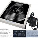 Medical_Monitor_NM-SX18-A1900_1