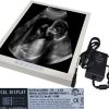 Medical_Monitor_NM-SX18-A1900_1600